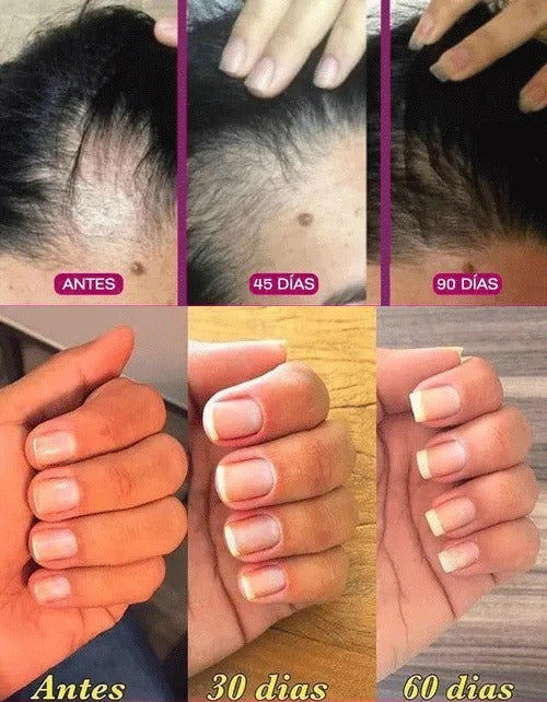 Gráfico de resultados uñas y pelo